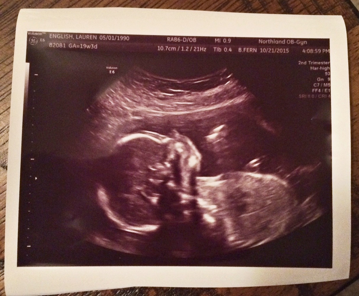 Baby English Ultrasound Picture